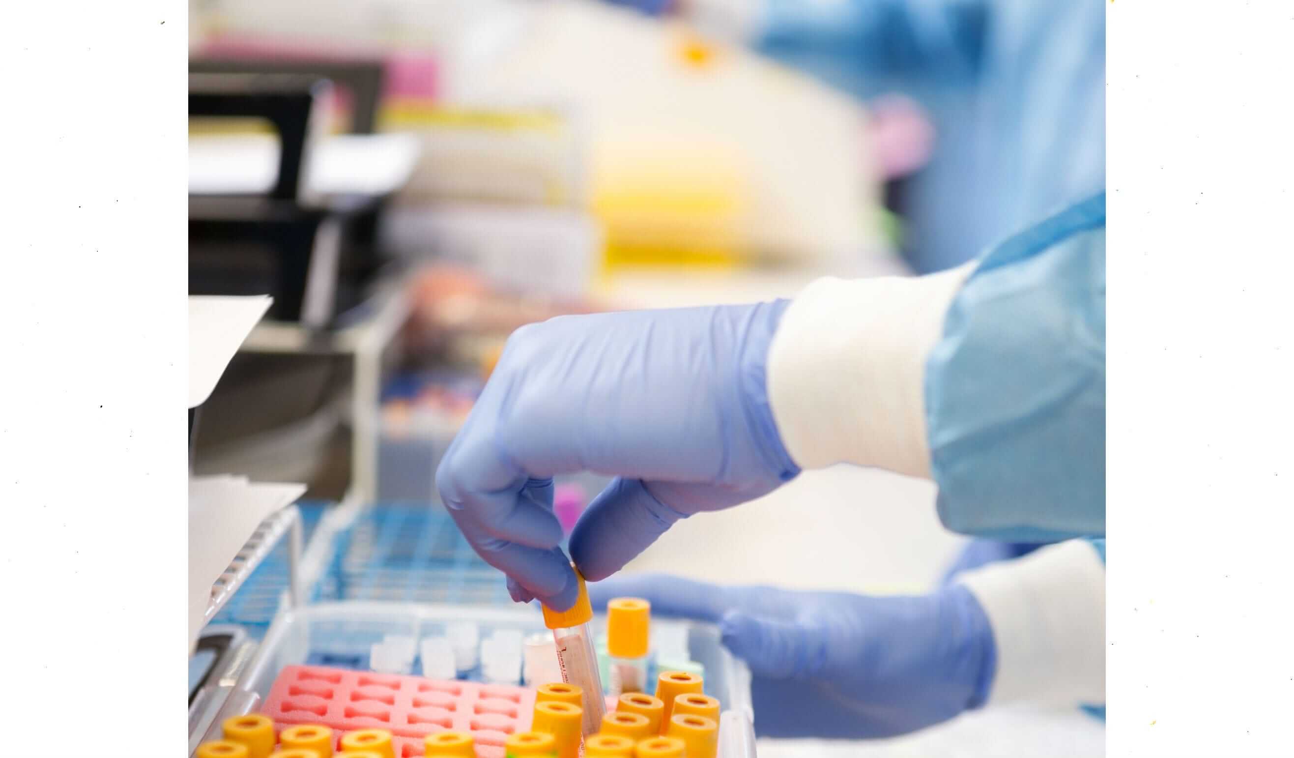 In Home Blood Test Revised Home Health Care