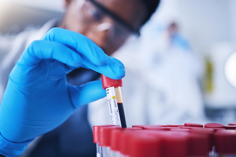 bloodtest-intro2