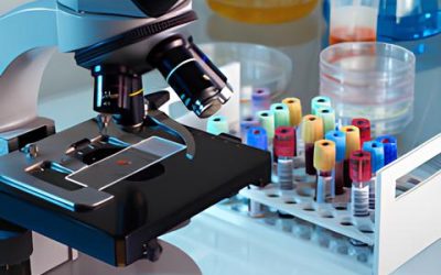 TB Test Montreal: What to Expect from a Mobile Home Service