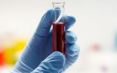 Syphilis Blood Test: Key Information Every Patient Should Know